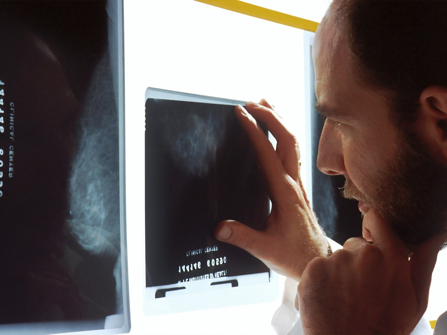 person holding black tablet computer